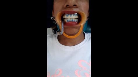 Gentlyperv Dentist Porn Videos .